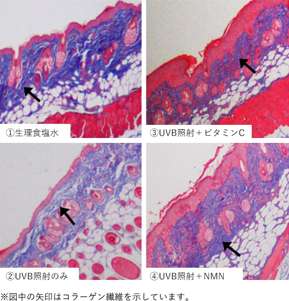 NMN摂取による紫外線からの皮膚の保護効果