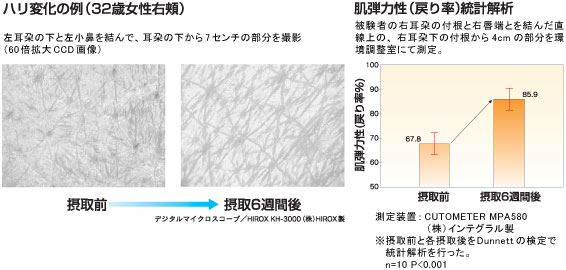 ハリ変化の例　肌弾力性（戻り率）統計解析