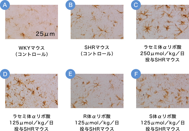 画像1. 前頭灰白質におけるGFAPサイズ変化