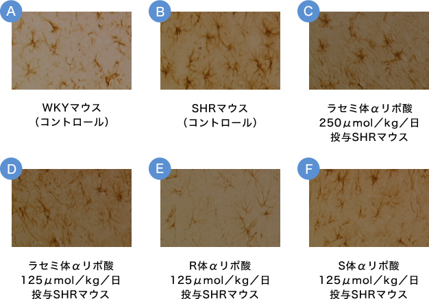 画像2. 海馬CA1におけるGFAPサイズ変化