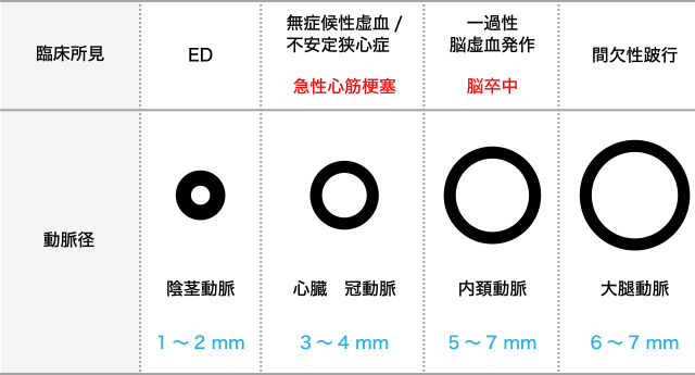 図1. EDは動脈硬化で生じる最初の『血管の病』