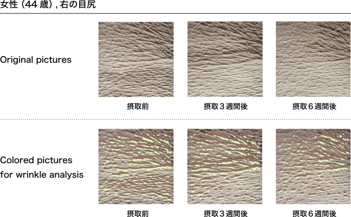 サンプル画像4. 肌のシワ変化