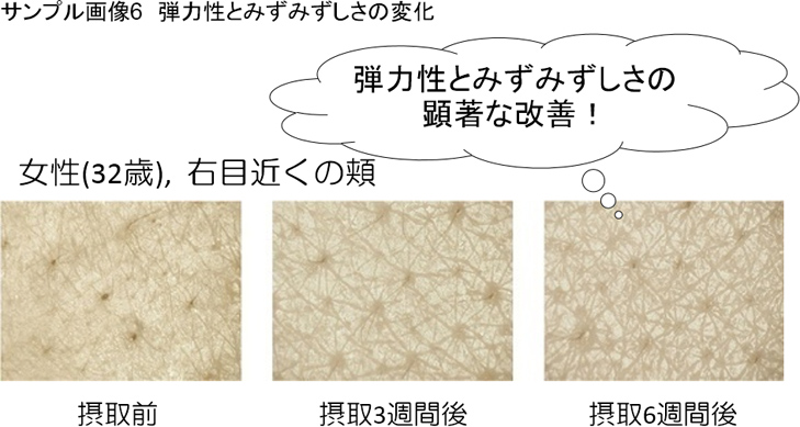 サンプル画像6 弾力性とみずみずしさの変化