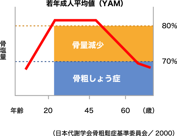 骨量を指標とした原発性骨粗しょう症診断基準