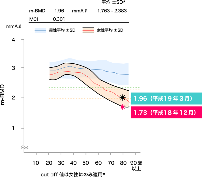 図1. 吸収型Q10(包接体)とビタミンCを配合したサプリメント摂取による骨密度の変化(その1)N.K(79歳女性)