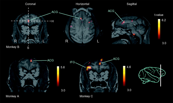 図2. 緑の香りによるサルの大脳前帯状皮質の活性化（陽電子放射形コンピューター断層撮影（PET）検査）