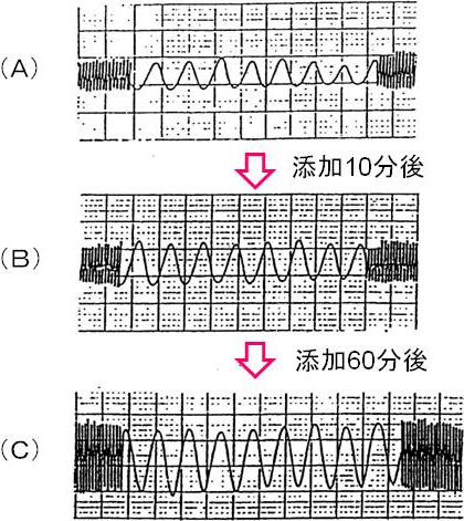 図1. CoQ10によるマウス心筋細胞の拍動変化