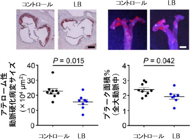 図2. バクテロイデス強制投与による動脈硬化病変サイズとプラークの減少