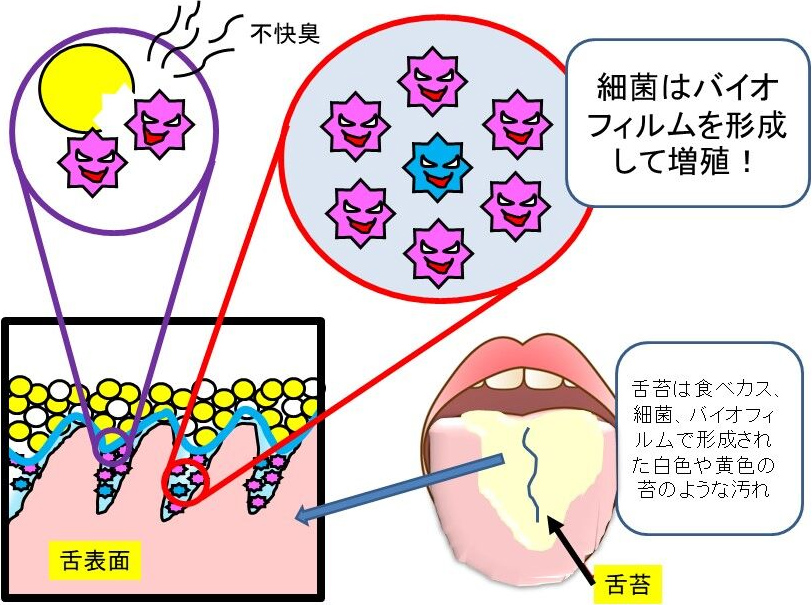 図1. 舌苔からの不快臭発生のメカニズム