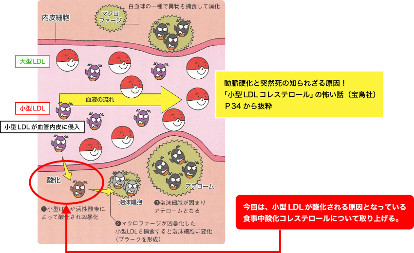 図1. 小型LDLコレステロールから動脈硬化を引き起こすアテローム生成のメカニズム