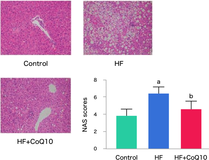 図8. 肝臓切片のヘマトキシリン＆エオシン（H&E）染色およびNAFLD活性スコア（NAS）