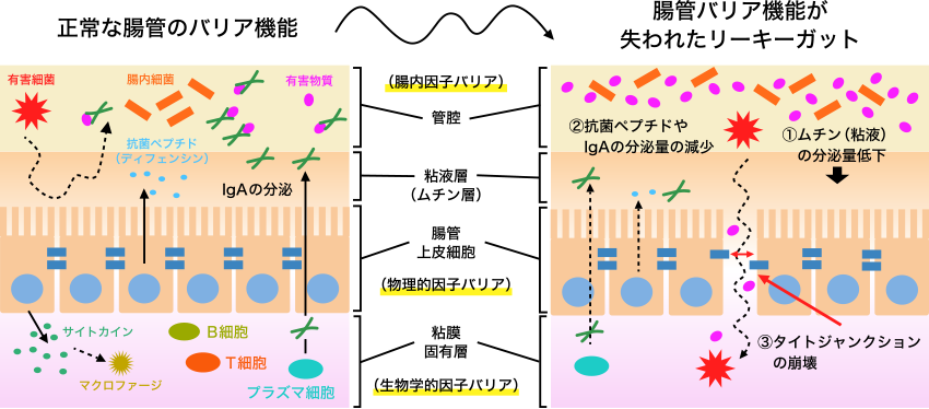 図. 正常な腸管とリーキーガット