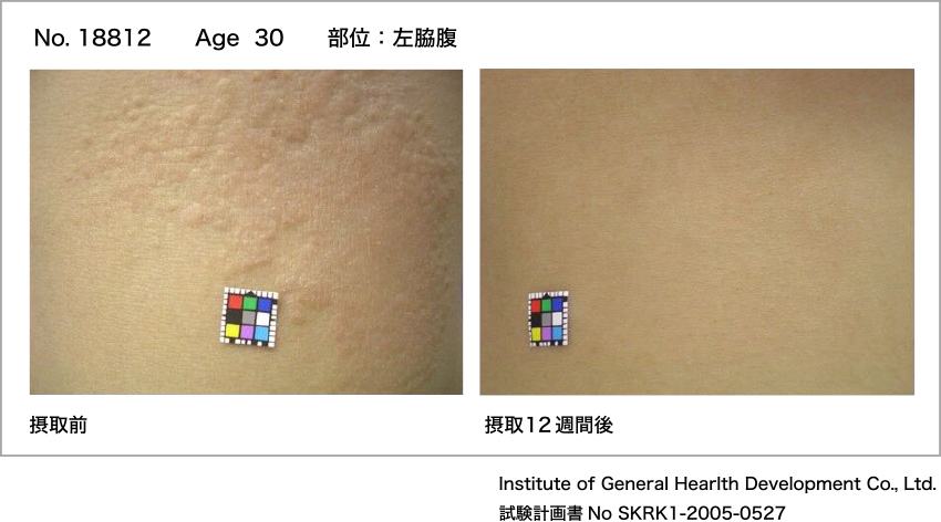 図9. 被験品摂取前後の観察画像