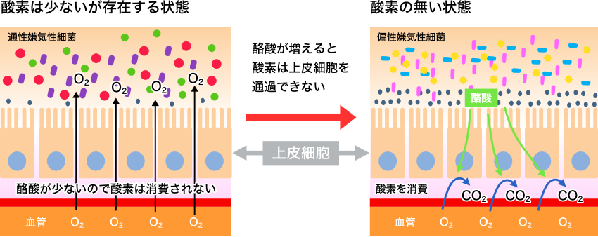 図2. 酪酸が善玉菌の活動しやすい環境を作る理由