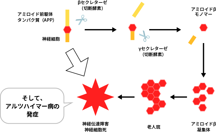 図2. アミロイド仮説（老人斑形成とアルツハイマー病発症）